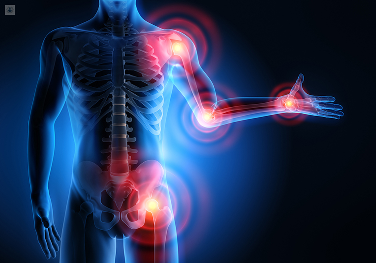 NEUROPATÍA – TEMAS VARIOS DE ALIMENTACIÓN Y SALUD NATURAL – 12 ABRIL 2022 – LUIS A MELON
