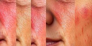 EL RETINOL – VITAMINA A Junio-30-2020 – LUIS ANTONIO MELÓN GÓMEZ